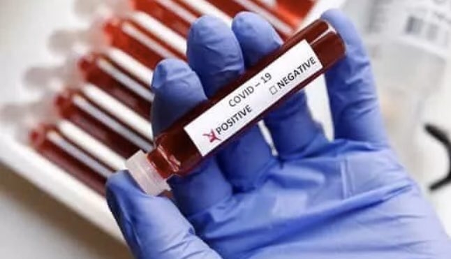 coronavirus. by .
