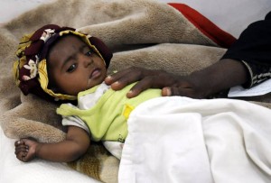 (170402) -- SANAA, April 2, 2017 (Xinhua) -- A woman puts her hand on her malnourished child waiting their turn to get treatment at a therapeutic feeding center in Sanaa, capital of Yemen, on April 2, 2017. Some seven million of people in Yemen could be put at risk by famine in 2017, Jamie McGoldrick, UN humanitarian coordinator for Yemen warned on March 28. McGoldrick said that an alarming 18.8 million of Yemeni people -- almost two thirds of the population -- need some kind of humanitarian or protection support, UN Deputy Spokesperson Farhan Haq told a daily briefing. (Xinhua/Mohammed Mohammed)